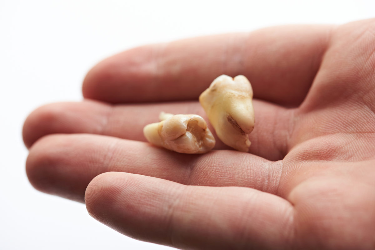 Tooth and Mouth Injuries