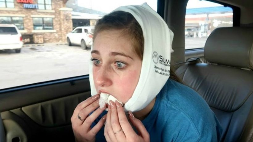 What To Wear For Wisdom Teeth Removal